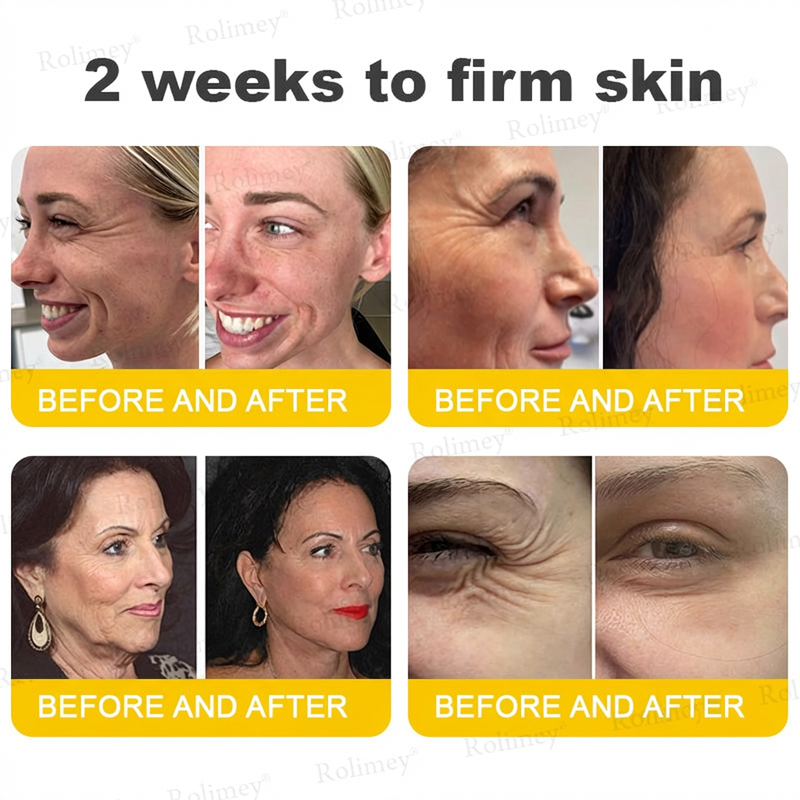 ⭐️Wrinkle-Lift⬆️ Botox & Vita A Retinol Shot Straffende Creme