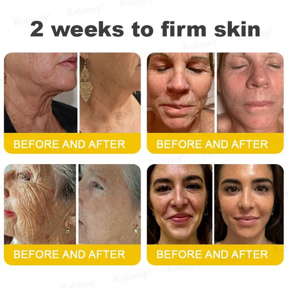 ⭐️Wrinkle-Lift⬆️ Botox & Vita A Retinol Shot Straffende Creme