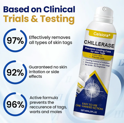 Celsiora® ChillErase Kühlspray für Hautanhängsel