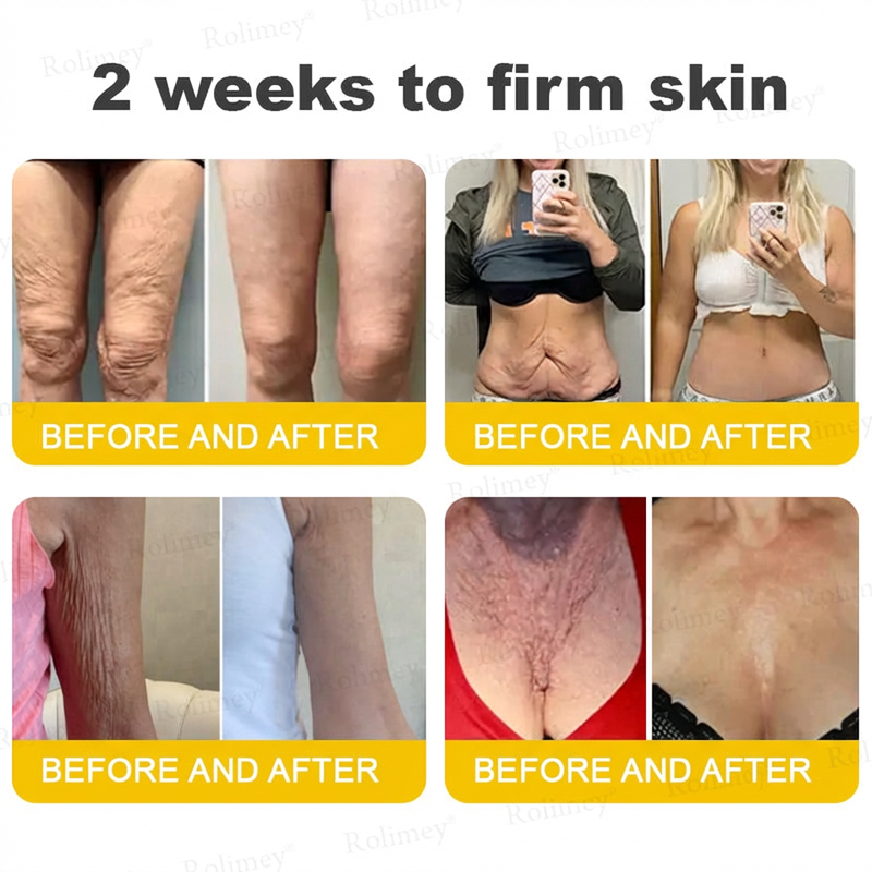 ⭐️Wrinkle-Lift⬆️ Botox & Vita A Retinol Shot Straffende Creme