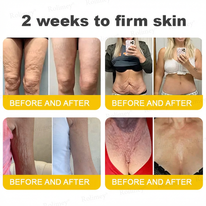 ⭐️Wrinkle-Lift⬆️ Botox & Vita A Retinol Shot Straffende Creme