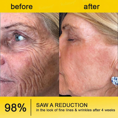 ⭐️Wrinkle-Lift⬆️ Botox & Vita A Retinol Shot Straffende Creme