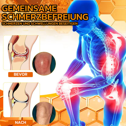 ✨flysmus® Bienengift Sofort-Ultra-Stärke Schmerztherapie-Creme🇩🇪