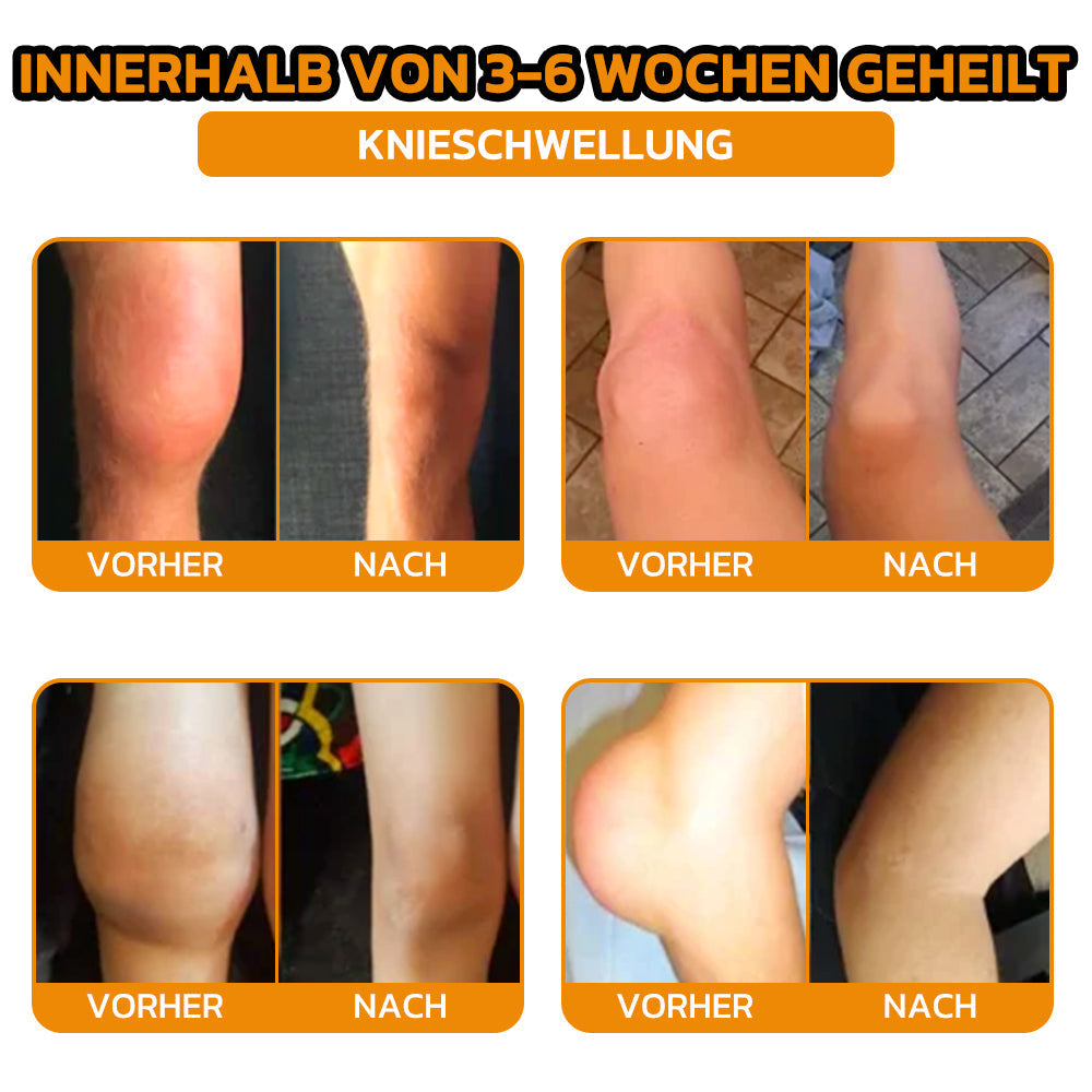 ✨flysmus® Bienengift Sofort-Ultra-Stärke Schmerztherapie-Creme🇩🇪