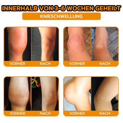 ✨flysmus® Bienengift Sofort-Ultra-Stärke Schmerztherapie-Creme🇩🇪