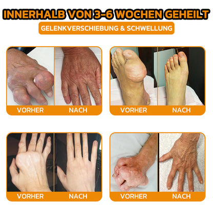 ✨flysmus® Bienengift Sofort-Ultra-Stärke Schmerztherapie-Creme🇩🇪