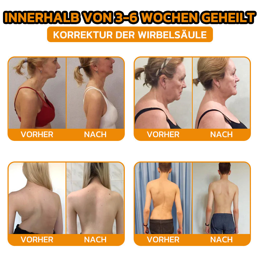 ✨flysmus® Bienengift Sofort-Ultra-Stärke Schmerztherapie-Creme🇩🇪