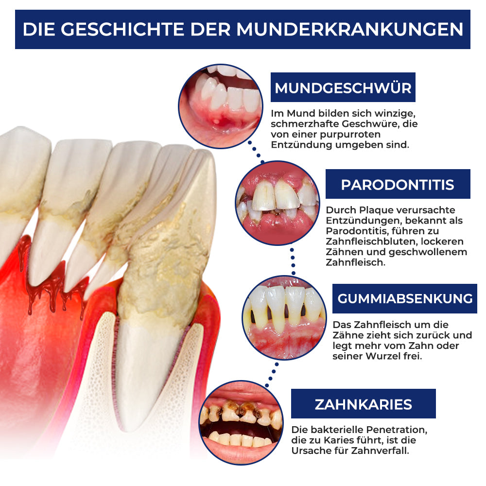 Rolimey® BeeTakt Bienengift-Zahnbehandlungstropfen Mundwasser