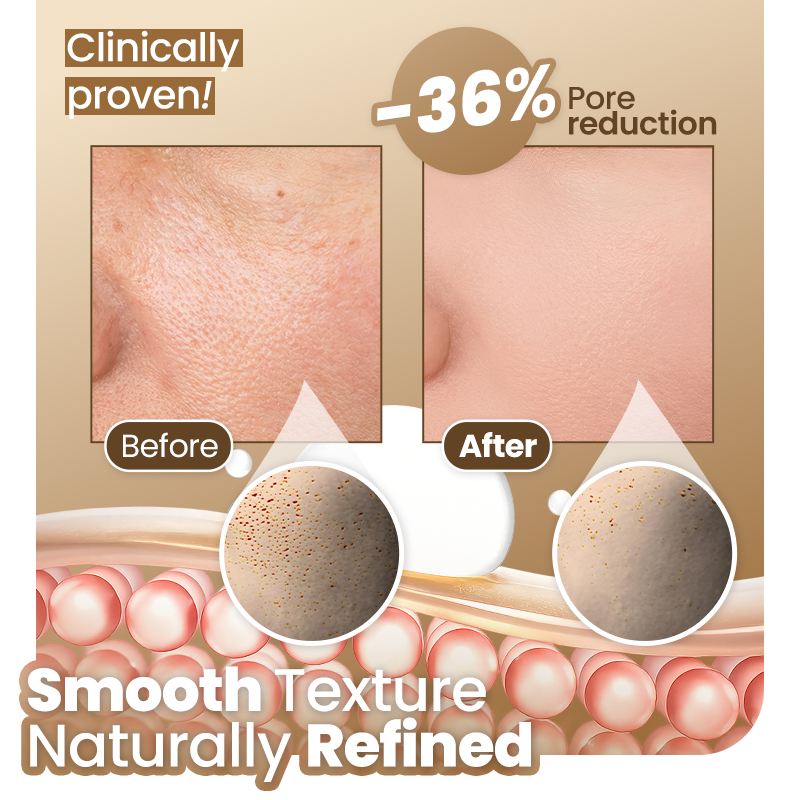 Celsiora® Sofort mattierender Balm mit Weichzeichner-Effekt👸