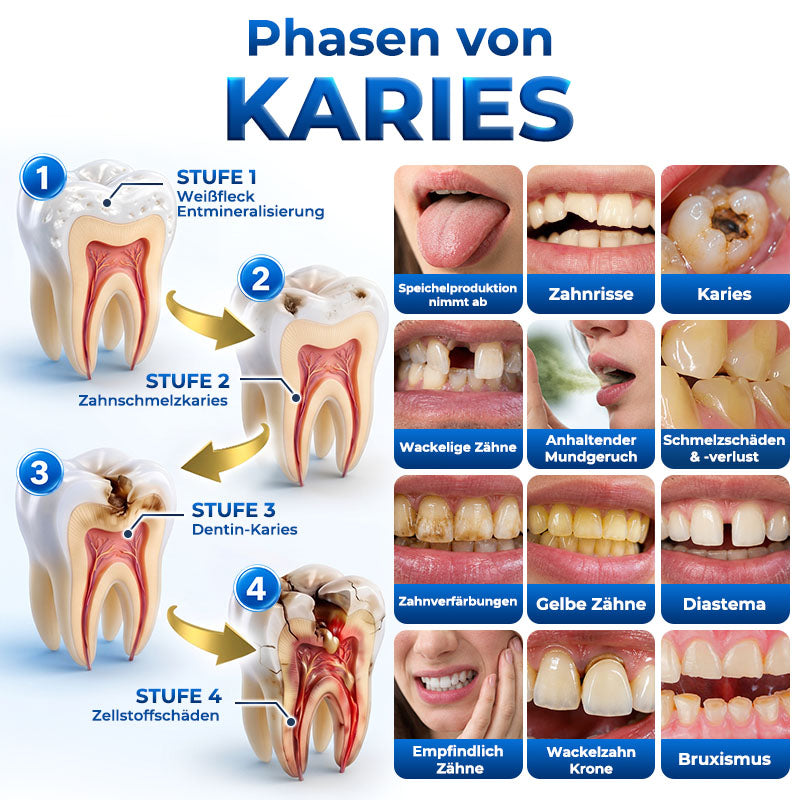 Rolimey® BioFill – Natürliches Zahnschmelz-Füllgel zur Kariessanierung
