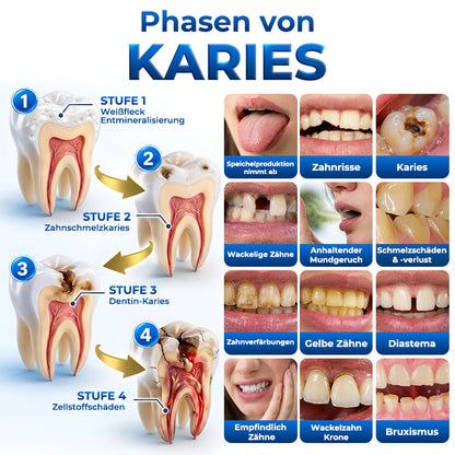 Rolimey® BioFill – Natürliches Zahnschmelz-Füllgel zur Kariessanierung