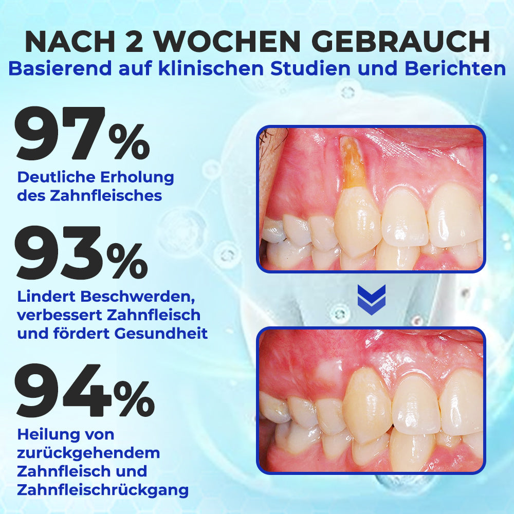 Rolimey® MicroSmile Zahnbehandlung mit Bienengift Ultrafeine Schaumzahnpasta mit Zungenschaber