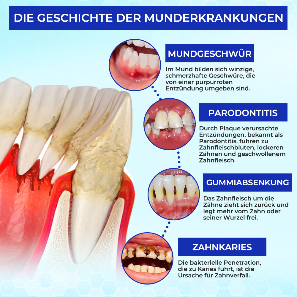 Rolimey® MicroSmile Zahnbehandlung mit Bienengift Ultrafeine Schaumzahnpasta mit Zungenschaber