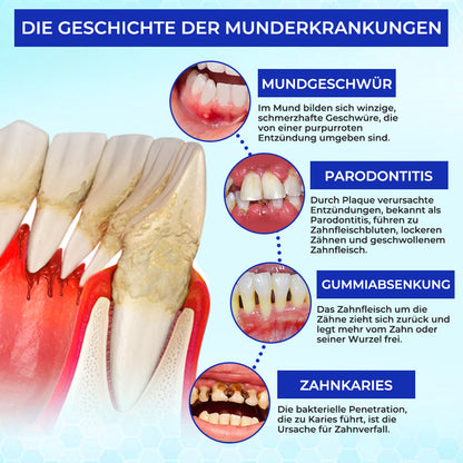 Rolimey® MicroSmile Zahnbehandlung mit Bienengift Ultrafeine Schaumzahnpasta mit Zungenschaber