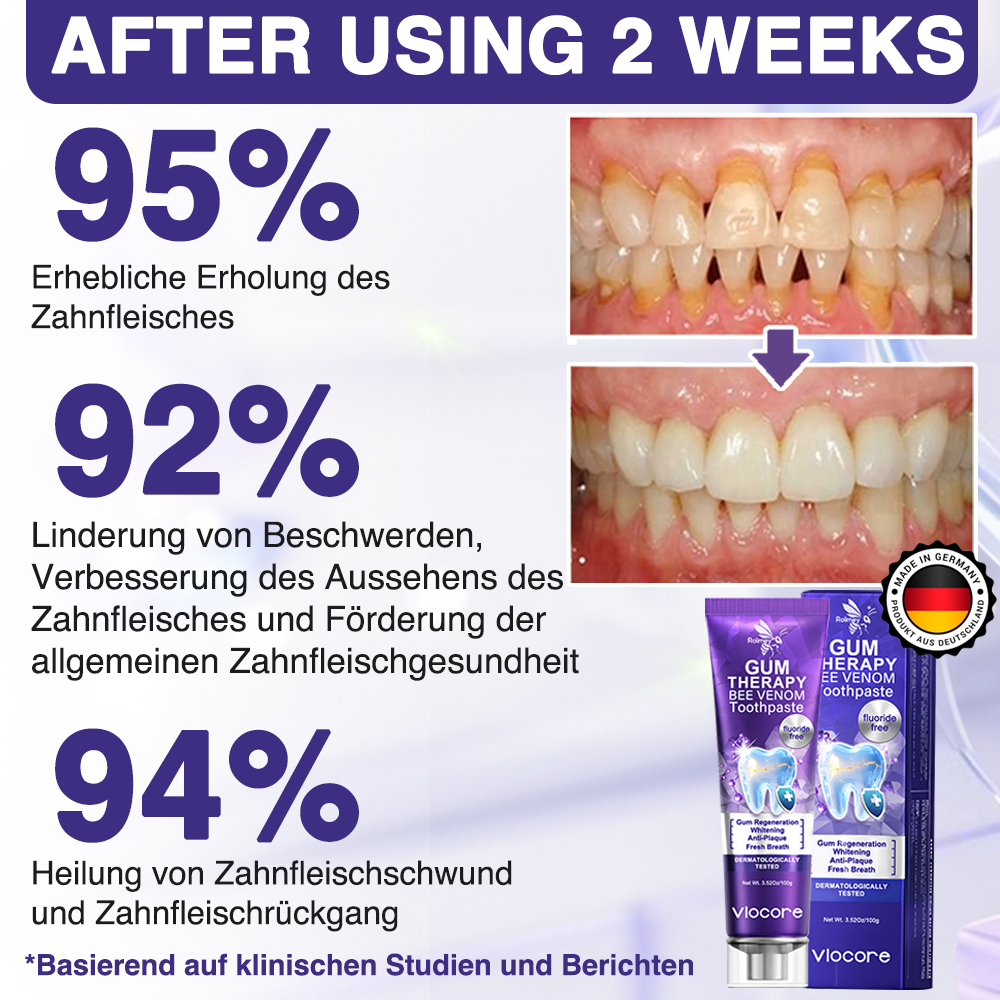 🇩🇪Rolimey® VioCore Zahnbehandlung mit Bienengift Lysozym-Zahnpasta🦷
